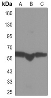 Cytochrome P450 17A1 Mouse Monoclonal Antibody
