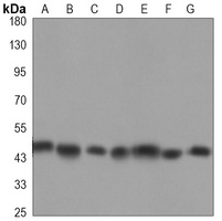Histone Deacetylase 3 Antibody