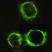 PDC-E2 antibody