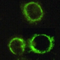 Anti-PDC-E2 Antibody