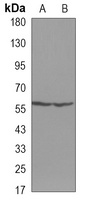 LCK Mouse Monoclonal Antibody