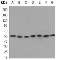 Beclin-1 Mouse Monoclonal Antibody