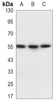 ALDH3A2 Mouse Monoclonal Antibody