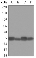 Beta-tubulin Antibody