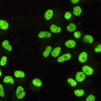 Anti-SAF-B1 Antibody