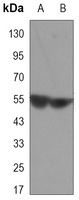 CaMK4 Mouse Monoclonal Antibody