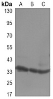 CDK4 Mouse Monoclonal Antibody