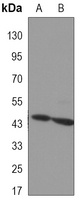 Aurora A Mouse Monoclonal Antibody
