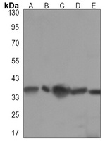 RAD51A Mouse Monoclonal Antibody