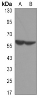 Ikaros Mouse Monoclonal Antibody