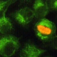 Anti-SIRT2 Antibody