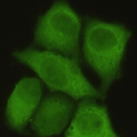 Anti-PP1 alpha Antibody