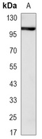 CD61 Mouse Monoclonal Antibody