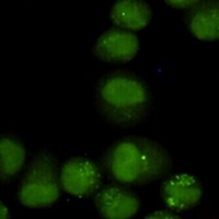 Anti-GTF2H1 Antibody