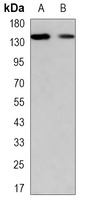 TIF1 gamma Antibody