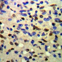 Anti-TIF1 beta Antibody