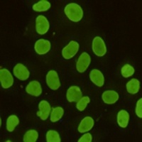 Anti-TIF1 beta Antibody