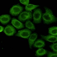 Anti-PDHA1 Antibody
