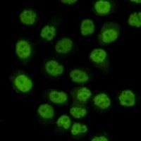 Anti-SMC1A Antibody