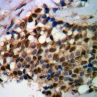 Anti-PPX Antibody