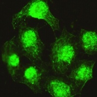 Anti-PPX Antibody