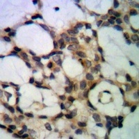 Anti-PP1 alpha Antibody