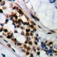 PRMT6 antibody