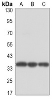 Nucleophosmin Antibody