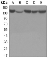 Histone Deacetylase 4 Mouse Monoclonal Antibody