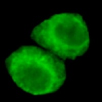 Anti-JMJD6 Antibody