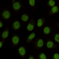 Anti-KDM1A Antibody