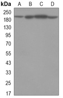 KDM5C Antibody