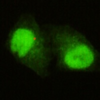 KDM5C Antibody