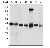 PP2C-alpha Mouse Monoclonal Antibody