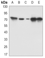 PKC beta Antibody