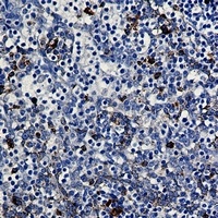 PKC beta Antibody