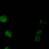 PKC beta Antibody