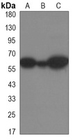 YTHDF1 Rabbit Monoclonal Antibody