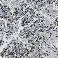 Anti-Visfatin Antibody