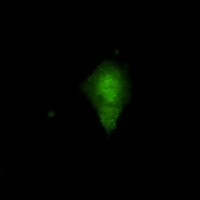 Anti-Visfatin Antibody