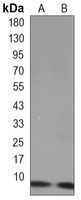 UBB Antibody