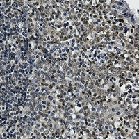 Anti-UBC9 Antibody