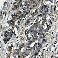 SOD1 antibody