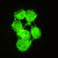 Anti-SOD1 Antibody