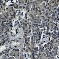 Anti-STAT5B Antibody