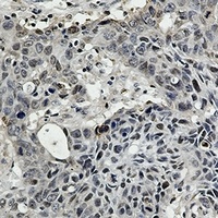 Anti-BRM Antibody