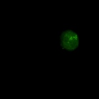 Anti-BRM Antibody