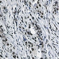 Anti-SAP155 Antibody