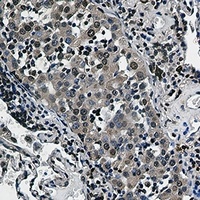 Anti-RSK2 Antibody