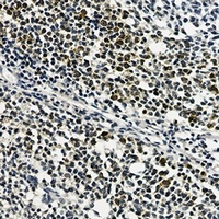 Anti-RPS20 Antibody